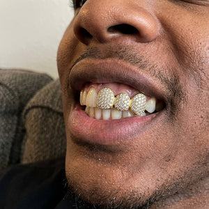 Iced Triple Cap VVS Moissanite Grillz
