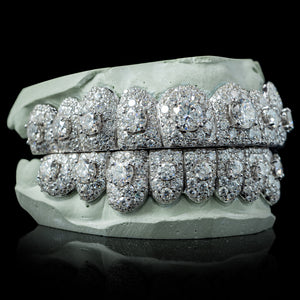 Iced VVS Moissanite Grillz with Large Center Stone