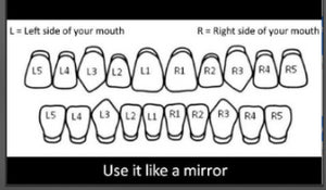 Iced Four Point Star Double Cap Grillz