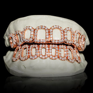 Iced VVS Moissanite Open Face Grillz