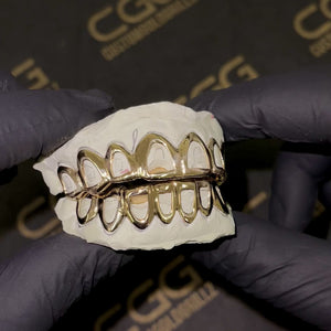 Solid Gold Open Face Grillz