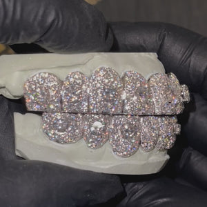 Iced VVS Moissanite Grillz with Large Center Stone