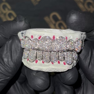 Iced VVS Moissanite Grillz (Zig Zag Setting)