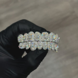 Iced VVS Moissanite Grillz with Large Center Stone