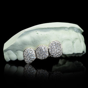 Iced Triple Cap VVS Moissanite Grillz