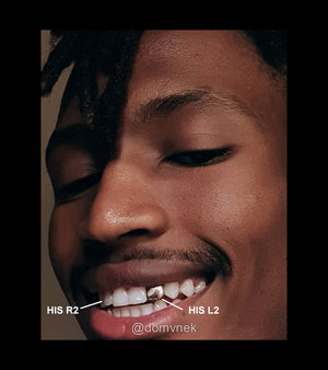 SOLID GOLD DOUBLE CAP TOOTH GRILLZ