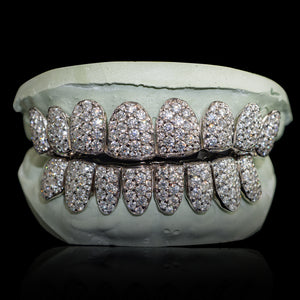 Iced VVS Moissanite Grillz with Large Moissanites (Zig Zag Setting)