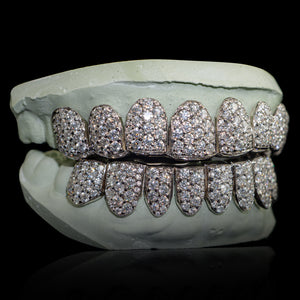 Iced VVS Moissanite Grillz with Large Moissanites (Zig Zag Setting)