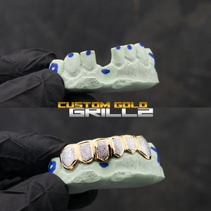 Solid Gold Two Tone Diamond Dust Grillz