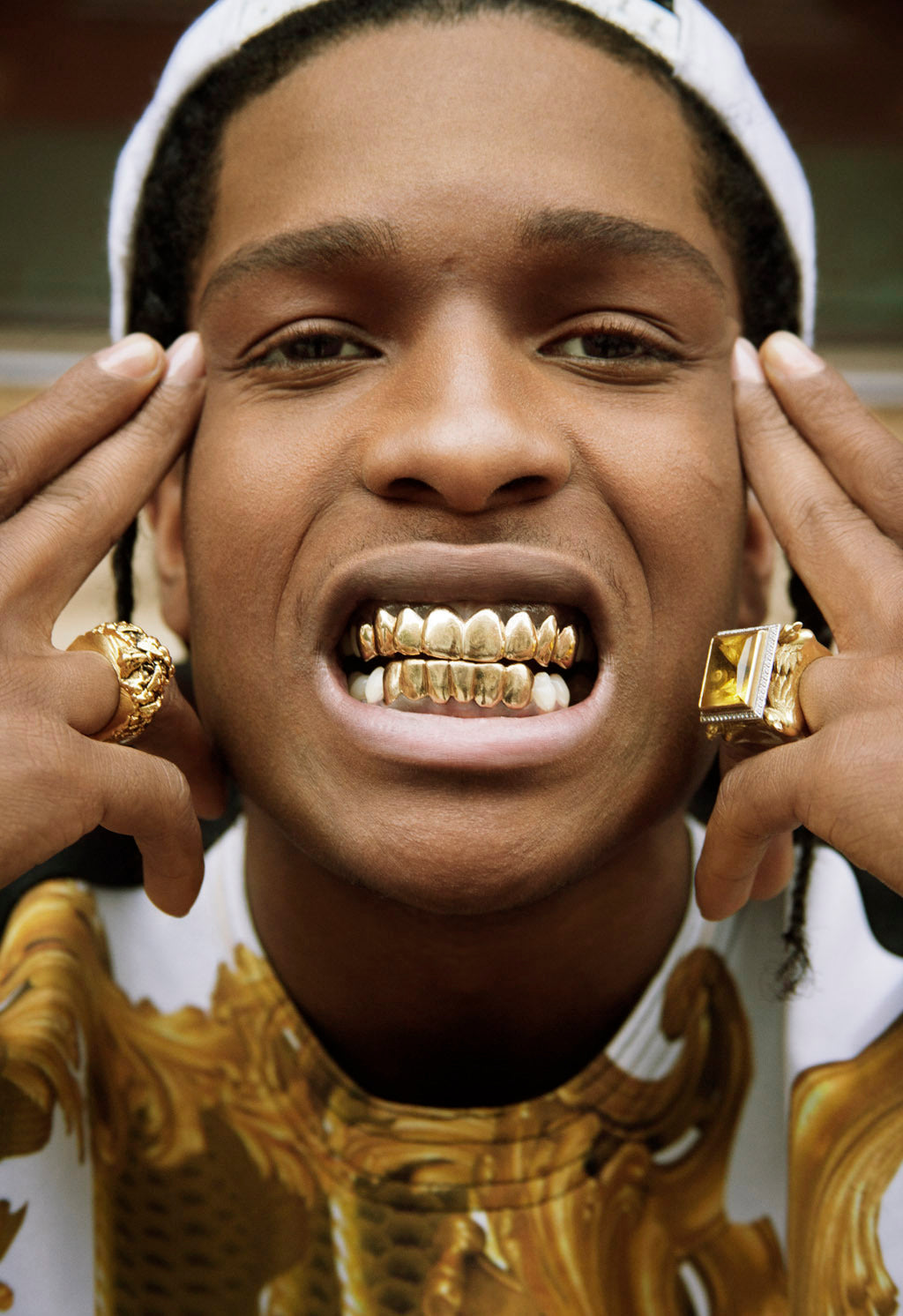 Should you get Permanent Grillz? (Answered By Experts)