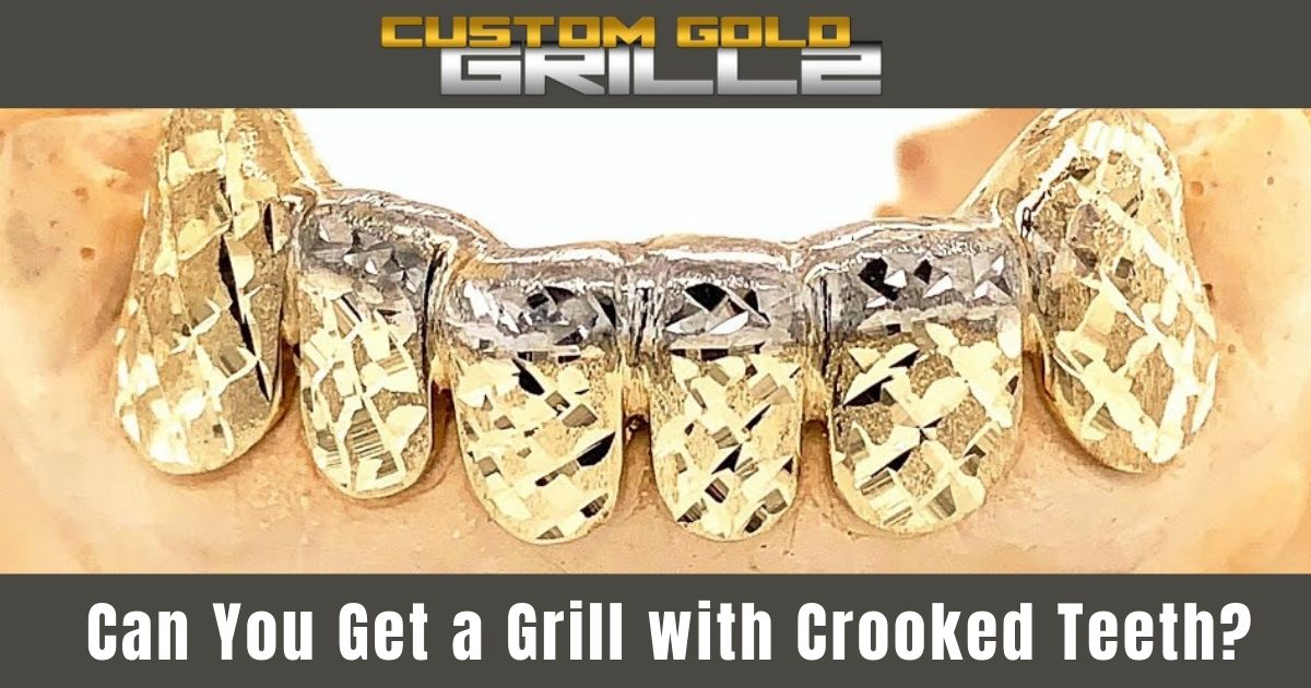 Can You Get a grill with Crooked Teeth [Answered]