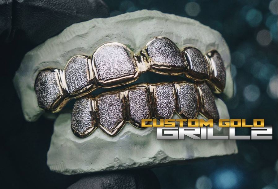 How Long Does Custom Gold Grillz Take?