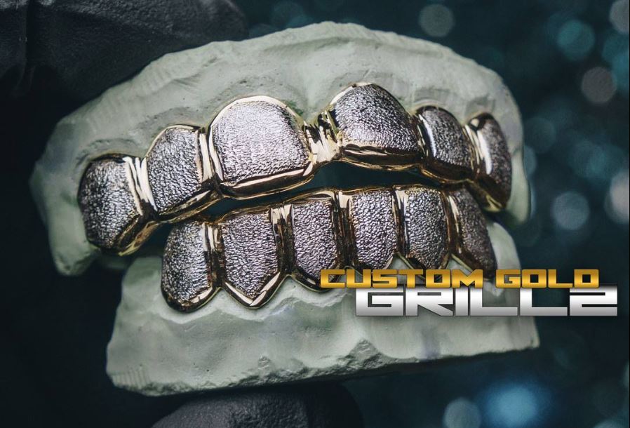 Custom Gold Grillz Production Timeframe: How Long Does it Take?
