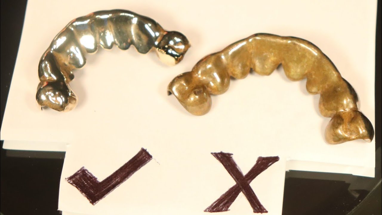 Does 10K Gold Tarnish Over Time? Custom Gold Grillz