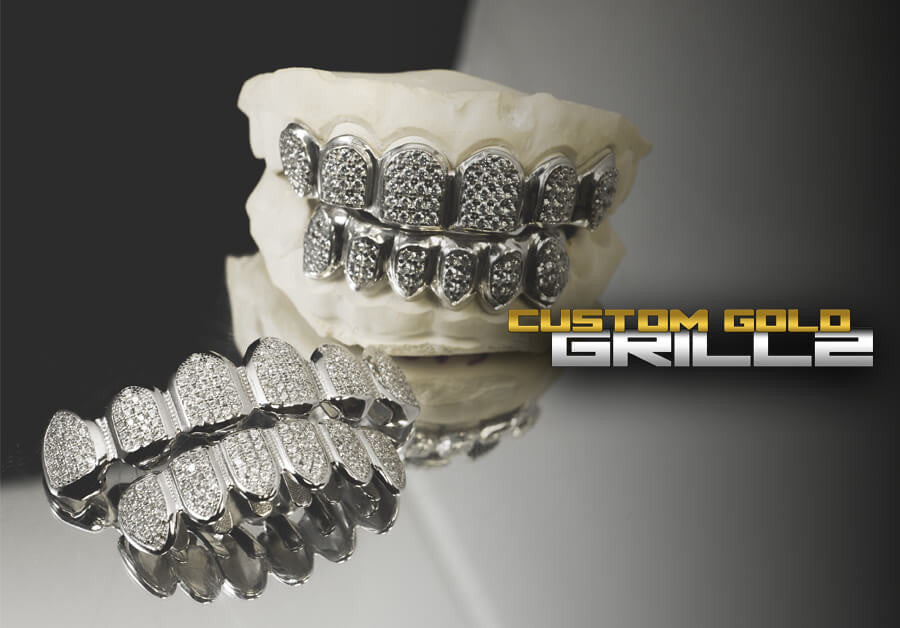 Solid Gold Grillz vs Gold Plated Grillz