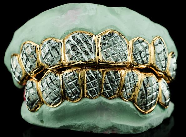 Top Local Gold Grillz Buyers: Sell Your Grillz Near Me