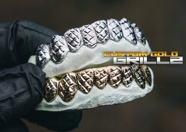 Can You Put Grillz on Dentures? - Comprehensive Guide & Safety Tips