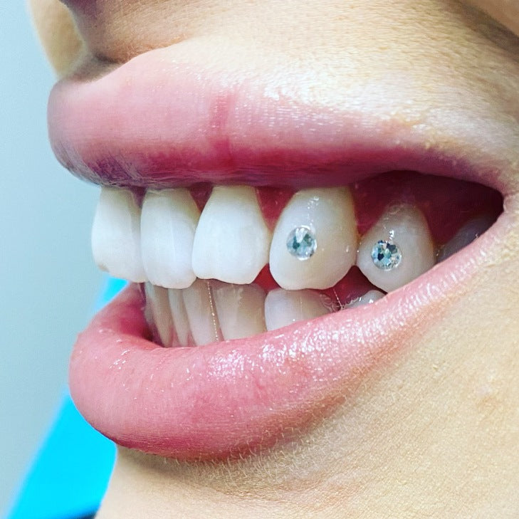 permanent diamond tooth gem