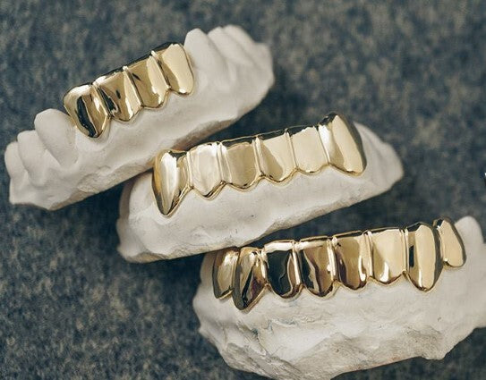 Where can I get permanent gold teeth? [Answered] - Custom Gold Grillz