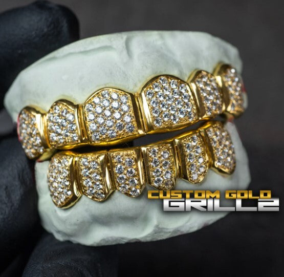How to make Grillz fit your teeth