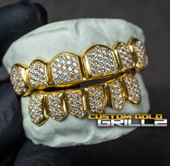 How Much Do Diamond Grill Cost? [Detailed Explaination] Custom Gold