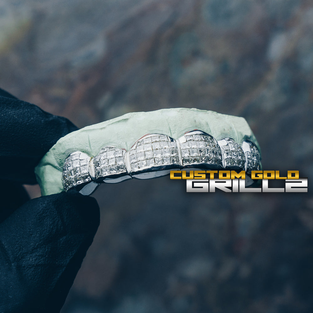 Permanent Grillz Everything You Need to Know about them! Custom Gold