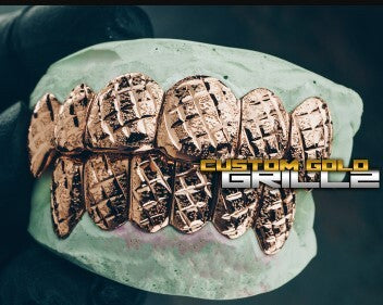 What is a grill for teeth? [Expert Answer]