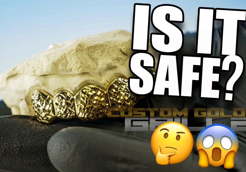 Are Grillz Safe to Wear?