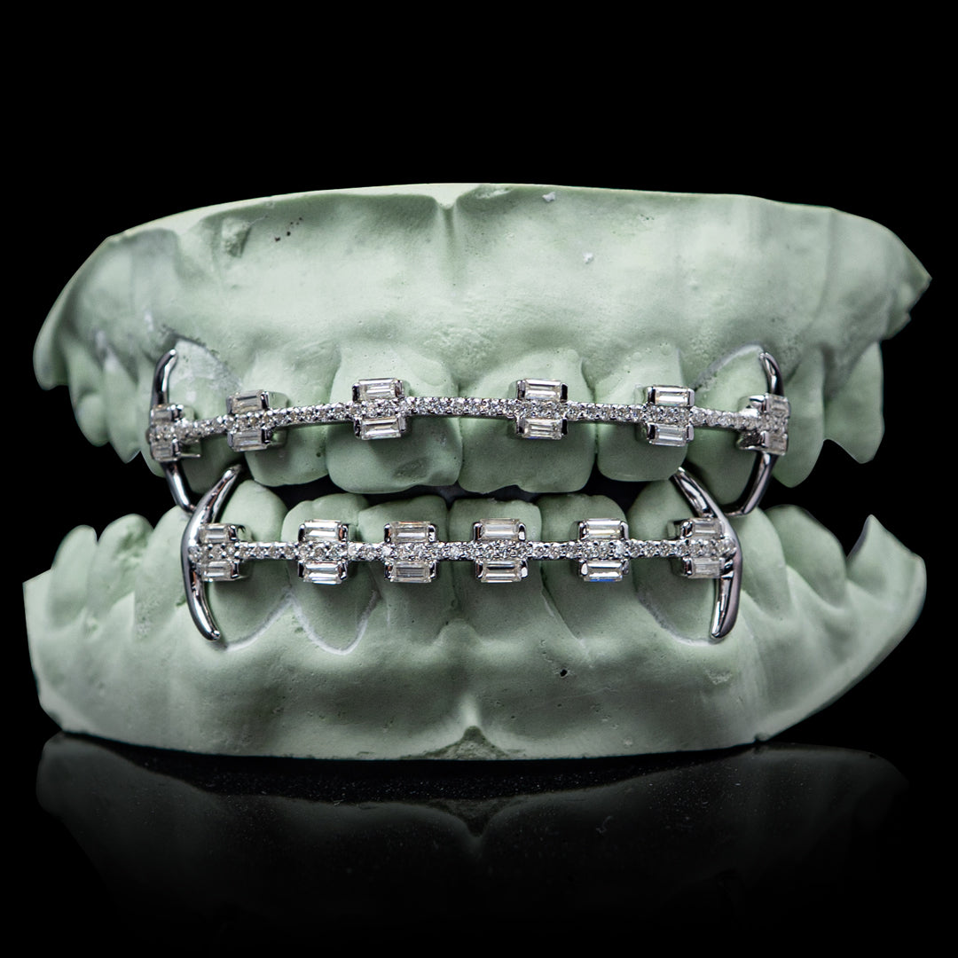 Baguette Braces Style Grillz
