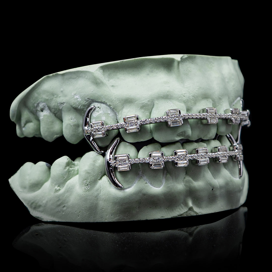 Baguette Braces Style Grillz