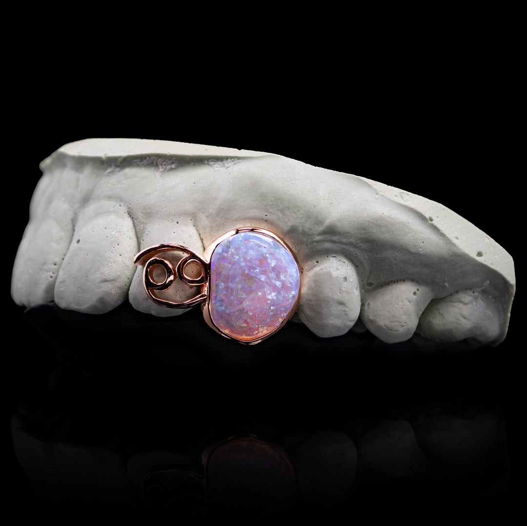 Cancer Opal Zodiac Sign Double Cap Grillz