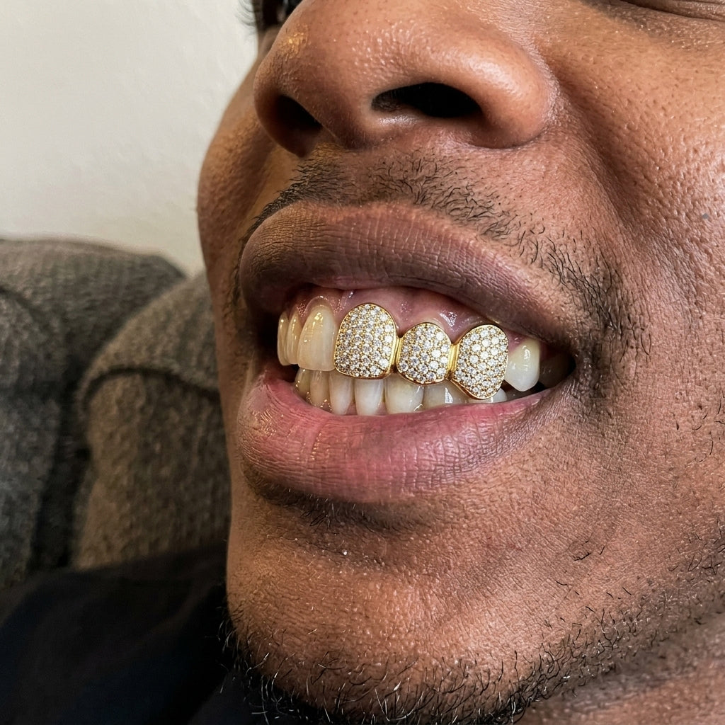 Iced Triple Cap VVS Moissanite Grillz