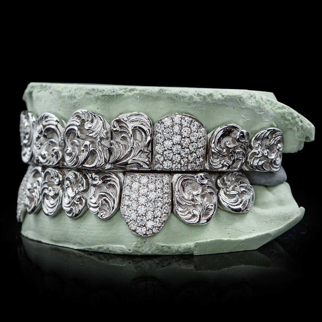 Filigree Iced Fangs Grillz | Flush Tip Design - Custom Gold Grillz