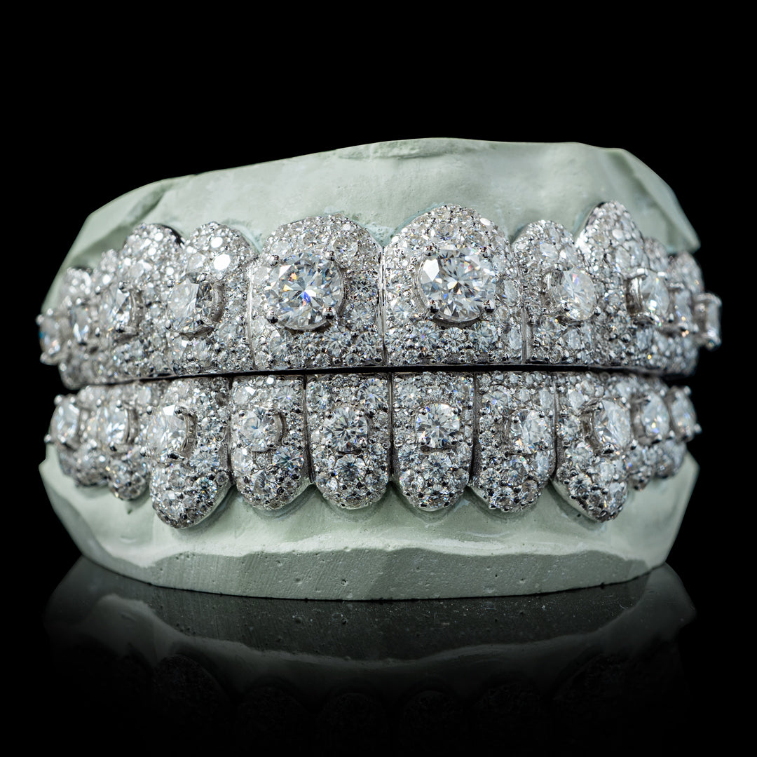 Iced VVS Moissanite Grillz with Large Center Stone