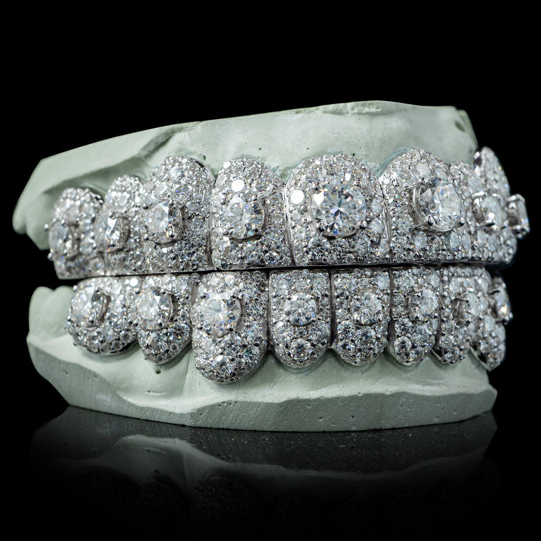 Iced VVS Moissanite Grillz with Large Center Stone