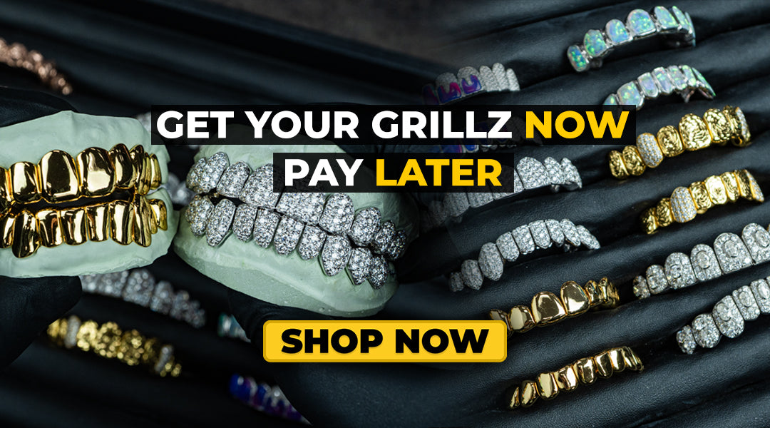 Custom Grillz Near Me for a Dazzling Smile Custom Grillz Near Me for a Dazzling Smile