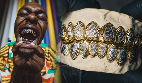 Buy Grillz Online: Order Gold & Silver Teeth - Custom Gold Grillz