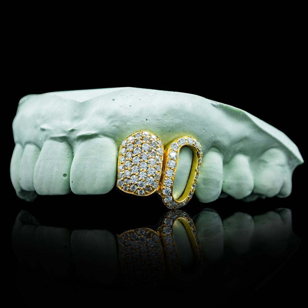 Iced Open Face Double Cap Grillz