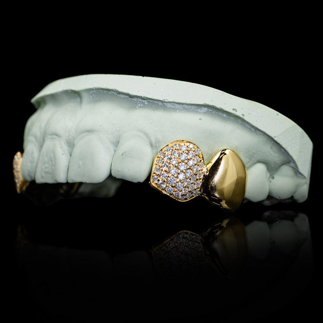 Solid and Iced Top Double Cap Grillz