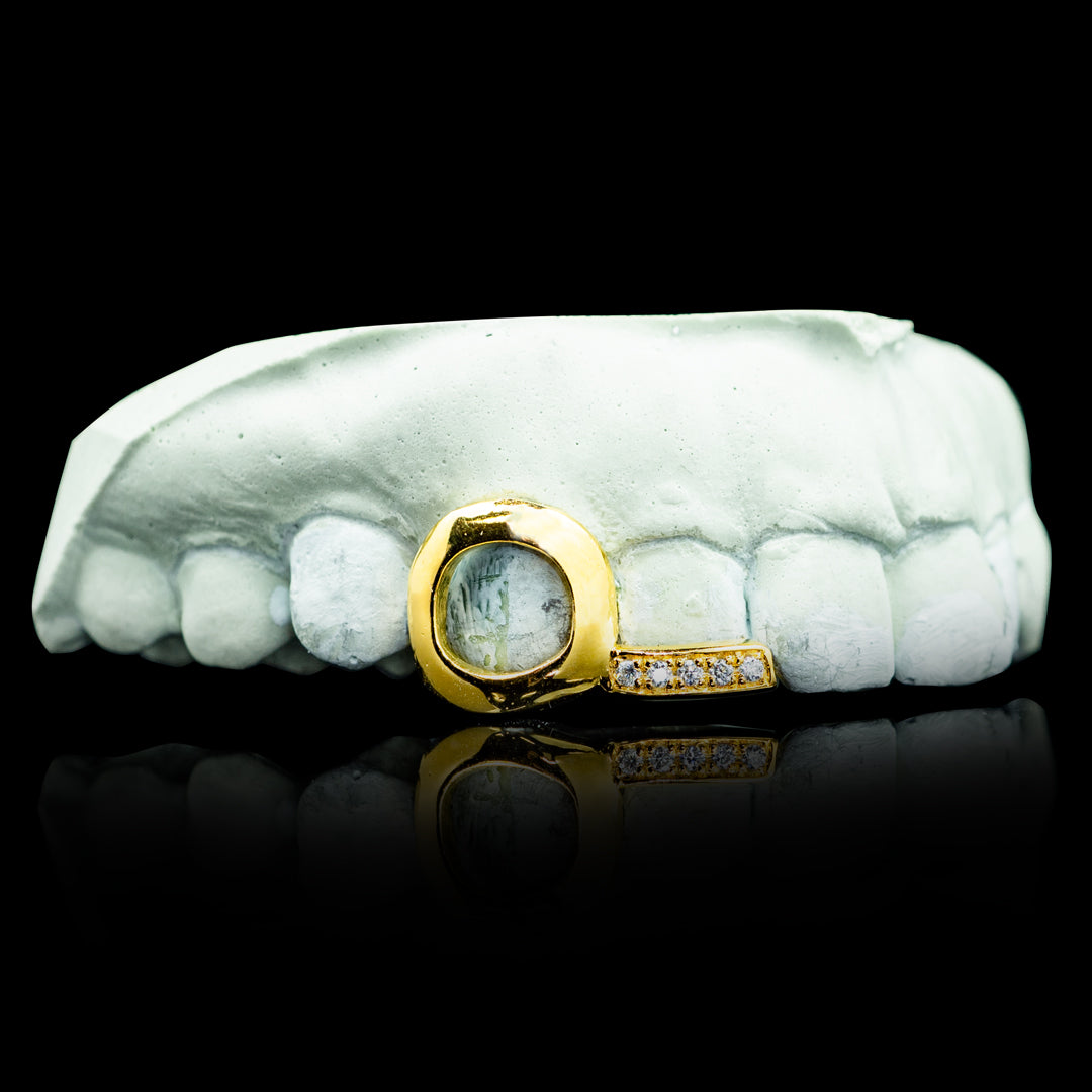 Open Face Iced Tip Double Cap Grillz