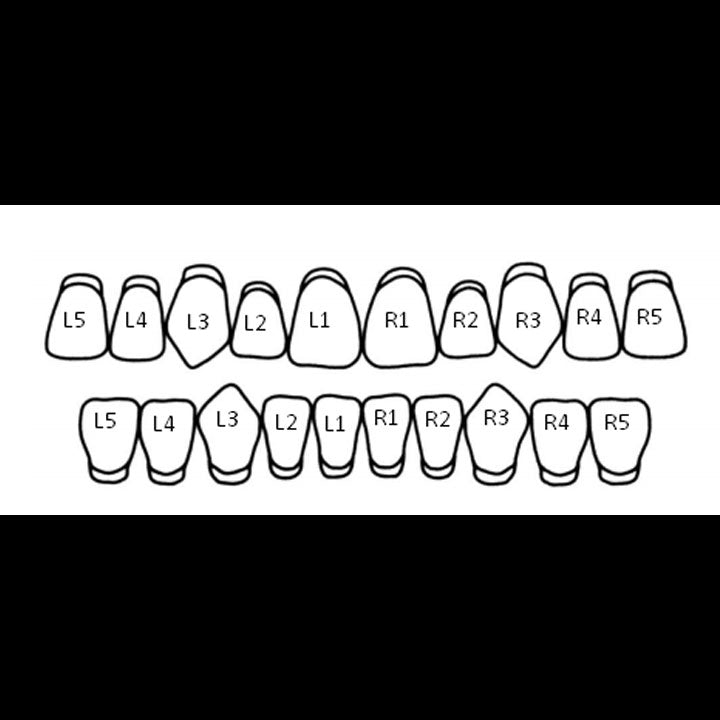 Tooth placement chart: L is your own left, R is your own right; numbers increase outward from the center
