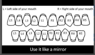 Iced Four Point Star Double Cap Grillz