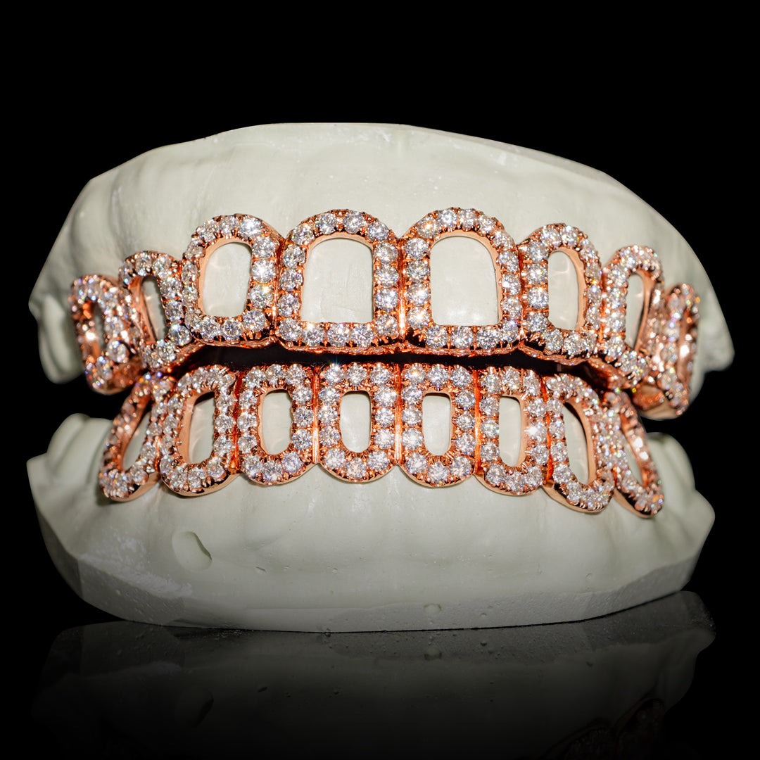 Iced VVS Moissanite Open Face Grillz