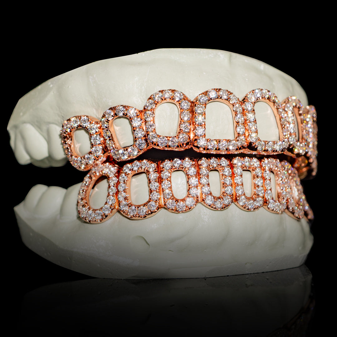 Iced VVS Moissanite Open Face Grillz