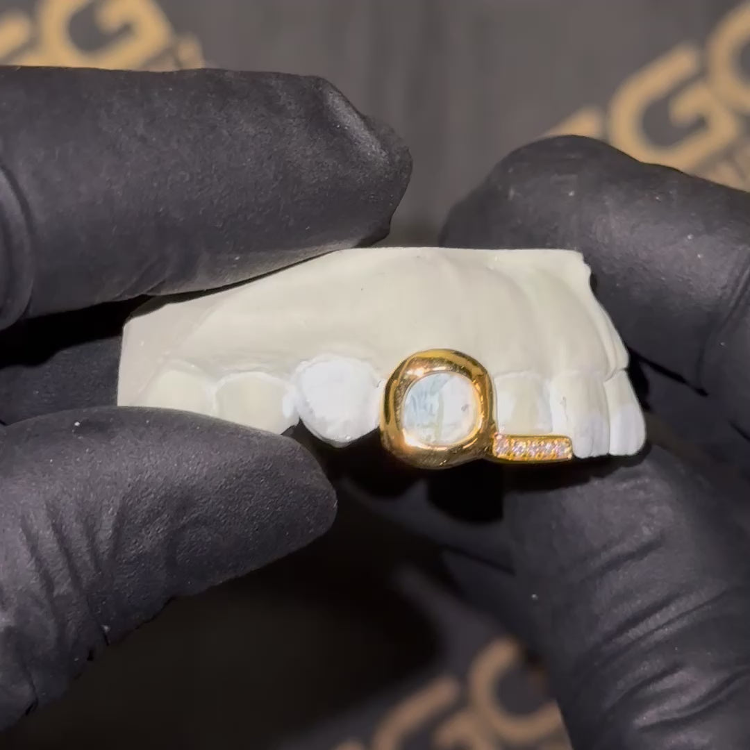 Open Face Iced Tip Double Cap Grillz