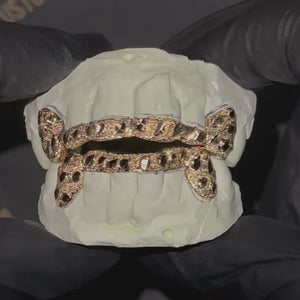 Solid Gold 6 Teeth Nugget Cut With Connecting Bridge Grillz Bar