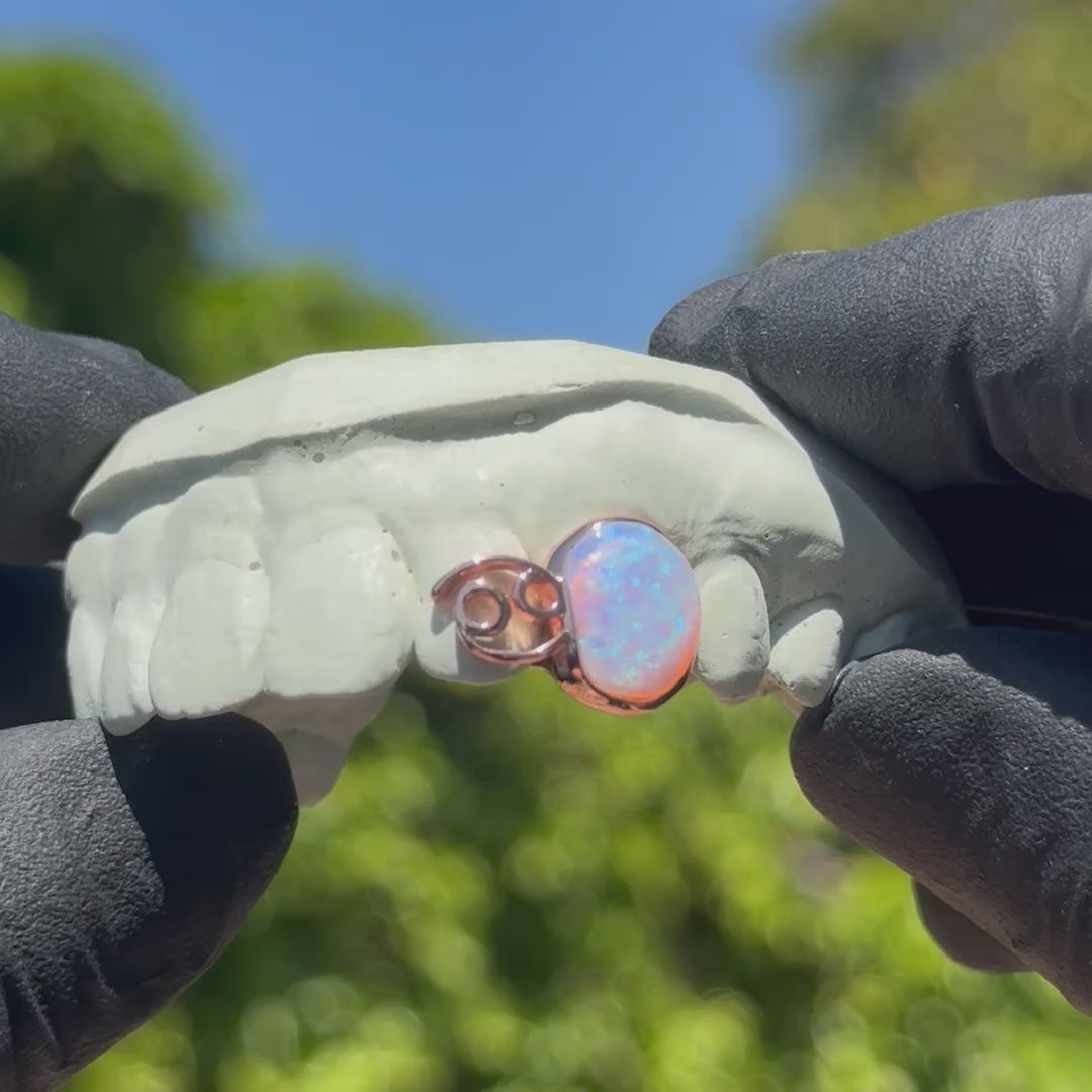 Cancer Opal Zodiac Sign Double Cap Grillz