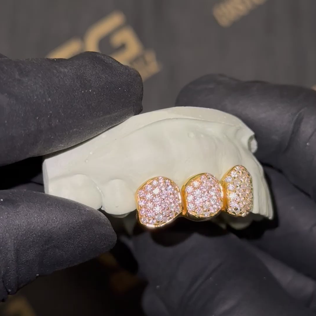 Iced Triple Cap VVS Moissanite Grillz