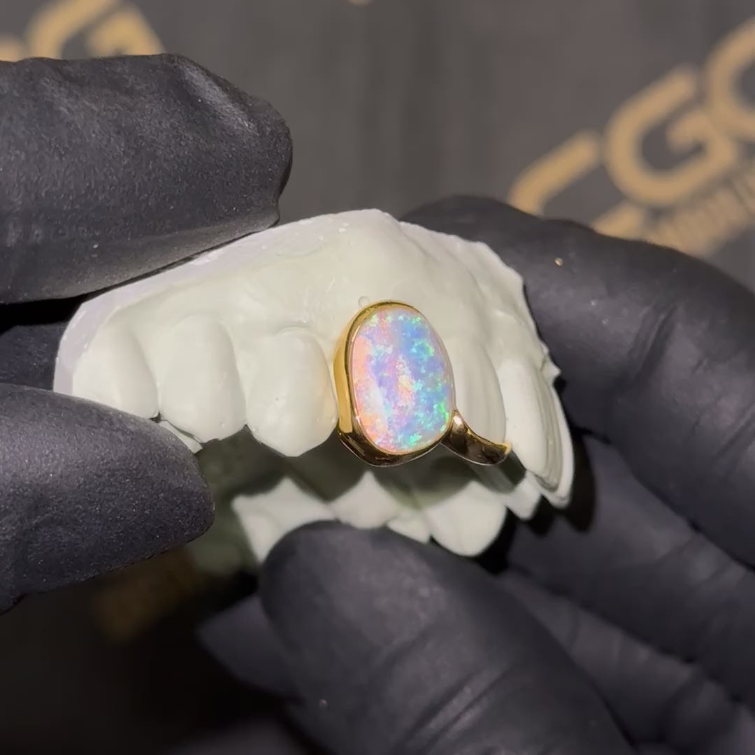 Opal with Solid Tip Double Cap Grillz
