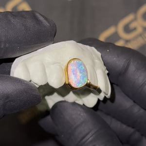 Opal with Solid Tip Double Cap Grillz
